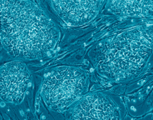 Human embryonic stem cells. Image adapted from Russo E (2005) Follow the Money—The Politics of Embryonic Stem Cell Research. PLoS Biol 3(7): e234. doi:10.1371/journal.pbio.0030234