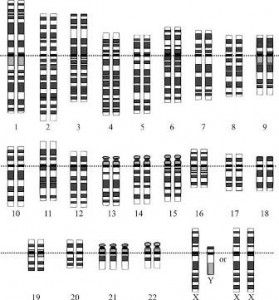 Trisomy 21 karyotype. All the normal chromosomes + 1. 