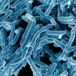 Mycobacterium tuberculosis- credit: NIH-NIAID (CC-BY)