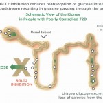 "Revolutionary" type 2 diabetes therapy to be released soon