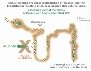 SGLT2 diabetes