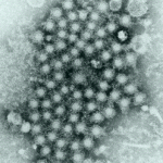Hepatitis viruses under an electron microscope