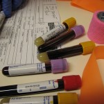 ‘Unwarranted’ hype surrounds new blood test for depression