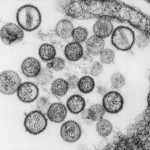 California hantavirus outbreak surprises experts