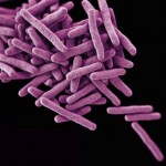 AstraZeneca neither confirms nor denies that it will ditch antibiotics research