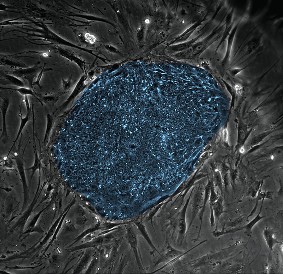 stem_cell_colony03-m_M.jpg