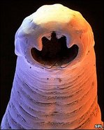 Thumbnail image for _45421768_hookworm226282.jpg