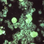 Cytomegalovirus—a ‘stealth’ pathogen—gains attention in the drug development realm