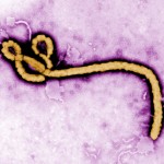 Electron micrograph of Ebola virus