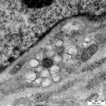 Cluster of vesicles made by virus from usurped and reshaped membranes.