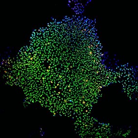 Thomson_IPS_cells09-m_M.jpg
